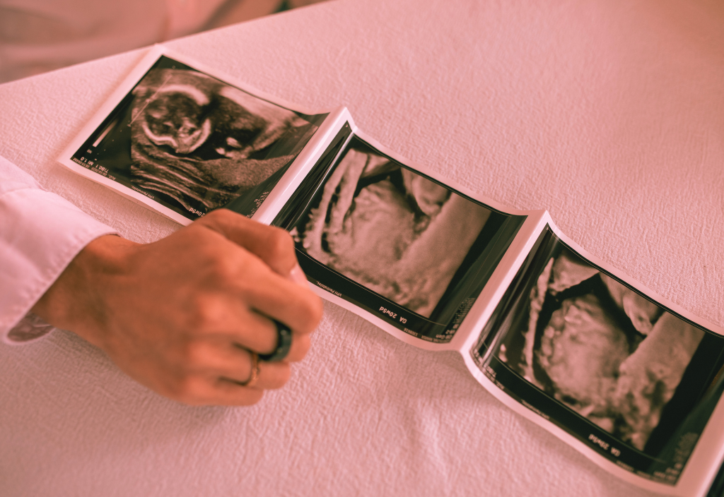 WELL-BEING & GROWTH SCAN - Future Baby 4D Scanning Studio Reading